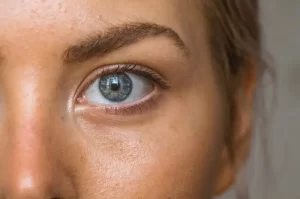 10 Effective Methods to Brighten Your Eyes