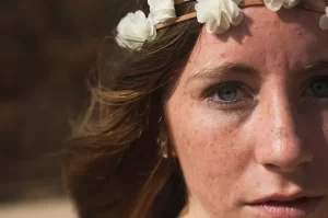Effective Strategies for Reducing Freckles