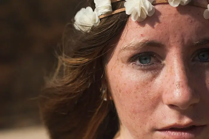 Effective Strategies for Reducing Freckles